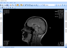 Portable MicroDicom screenshot