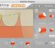 FabFilter Simplon x64